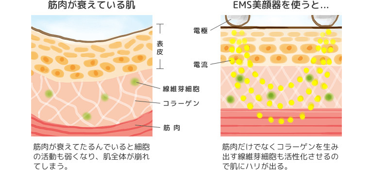電気パルス 電気パルス