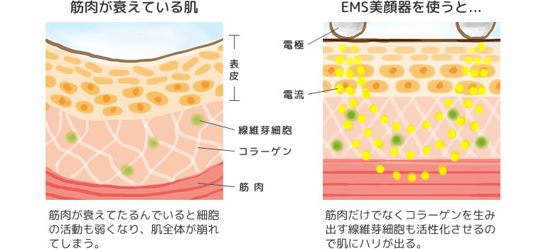 電気パルス