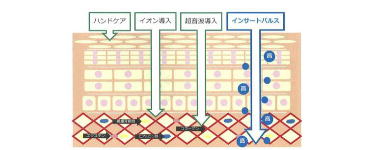 インサートパルス インサートパルス
